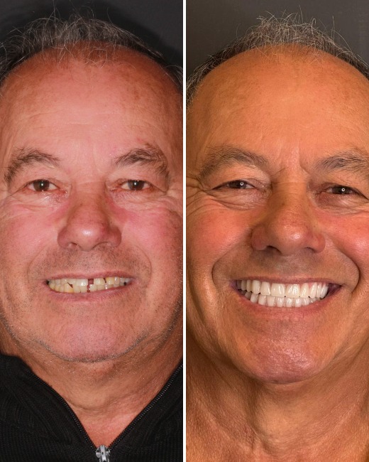 antes-depois-1775050645004